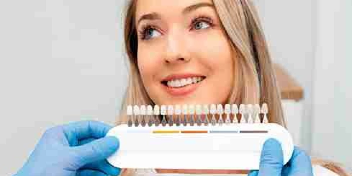 Teen Teeth Whitening: Guidance for Young Smiles
