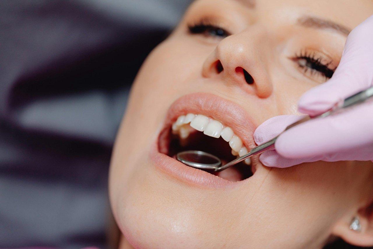 How Long Do Dental Restorations Really Last in San Mateo? | Articles | Frank Moore | Gan Jing World - Technology for Humanity | Video & Movie Streaming