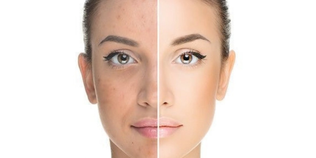 Best Dermatologists for Skin Whitening in Islamabad