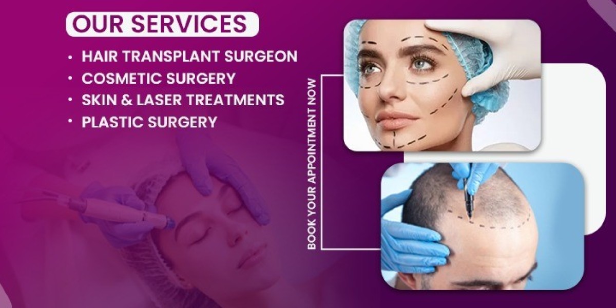 Best Hair Transplant in NCR – Achieve Fuller, Natural-Looking Hair with Expert Care